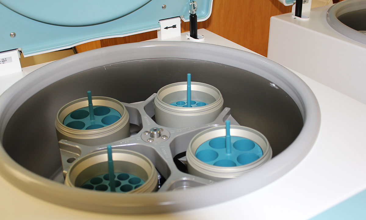 centrifuga de laboratorio funcion